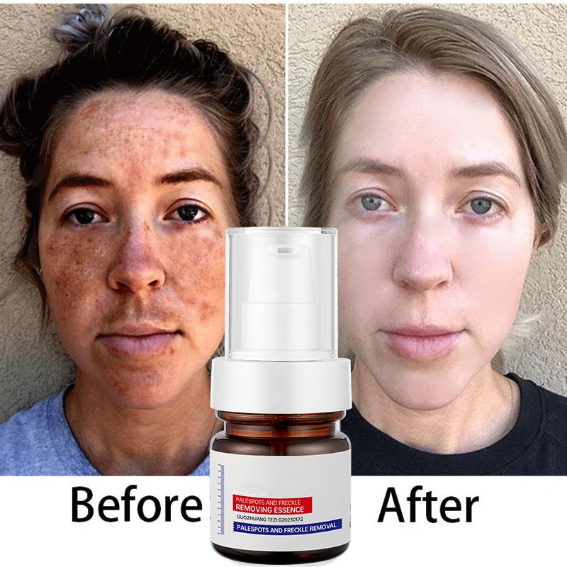 ✨Instant Glow Therapy: Fade freckles, erase spots & reveal luminous, youthful skin with Vitamin C Essence!
