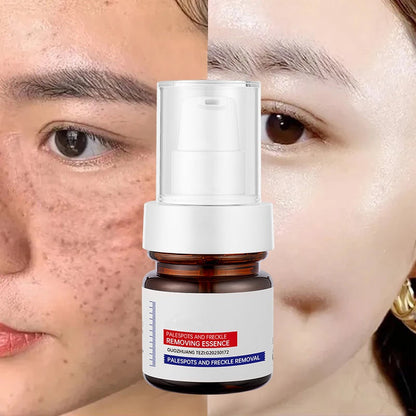 ✨Instant Glow Therapy: Fade freckles, erase spots & reveal luminous, youthful skin with Vitamin C Essence!