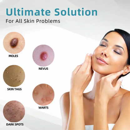 💎Erase Moles & Dark Spots Instantly with the At-Home CO₂ Laser Pen — Safe, Painless, and Now 50% OFF!