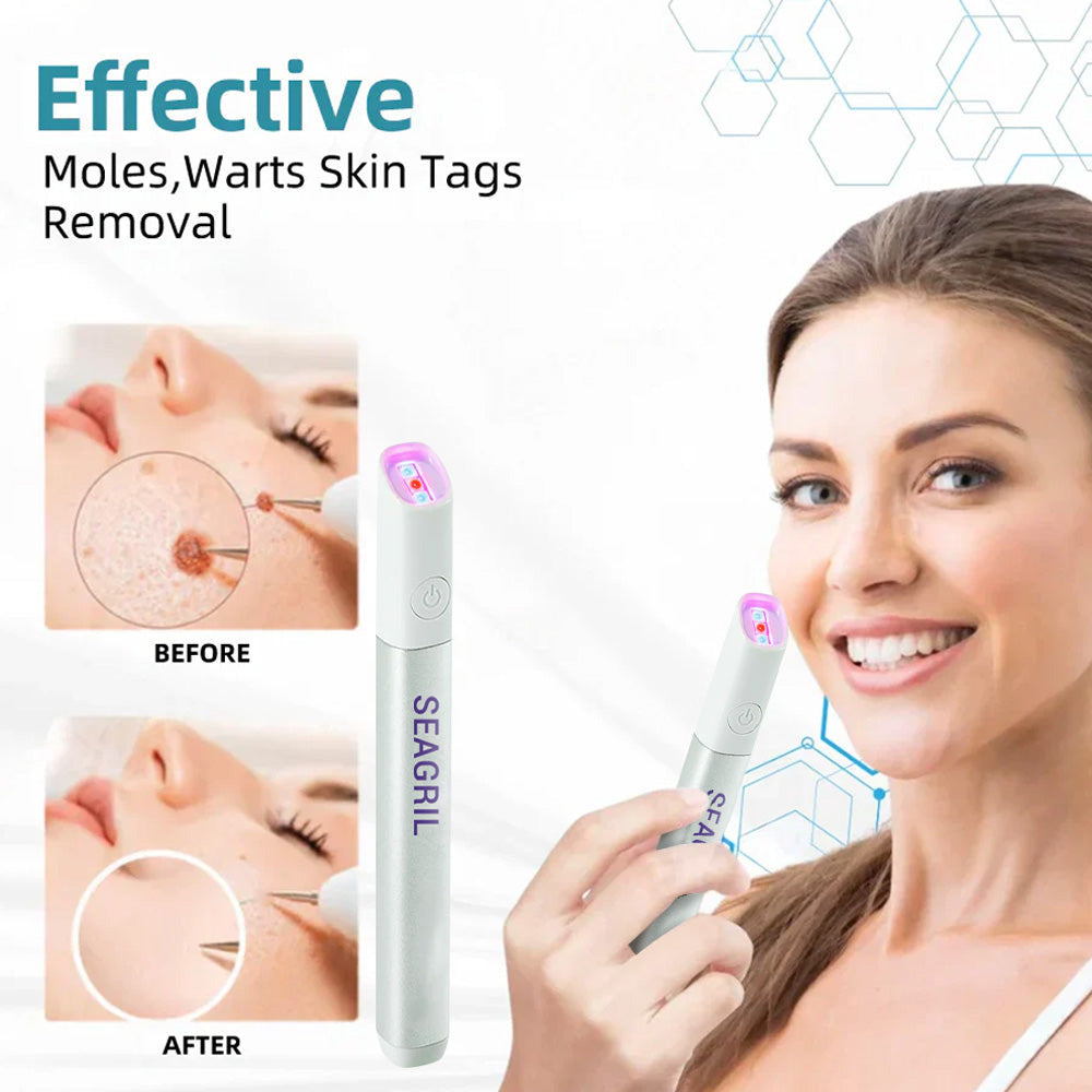 💎Erase Moles & Dark Spots Instantly with the At-Home CO₂ Laser Pen — Safe, Painless, and Now 50% OFF!