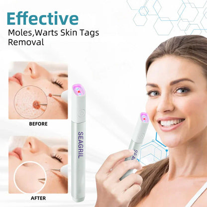 💎Erase Moles & Dark Spots Instantly with the At-Home CO₂ Laser Pen — Safe, Painless, and Now 50% OFF!